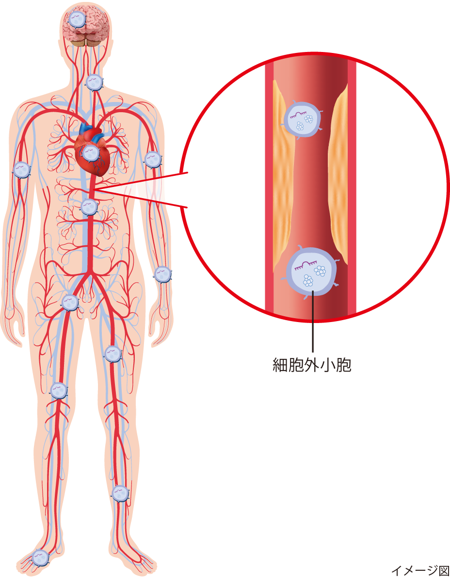 図3 全身をめぐる血管を通じて影響をおよぼす細胞外小胞