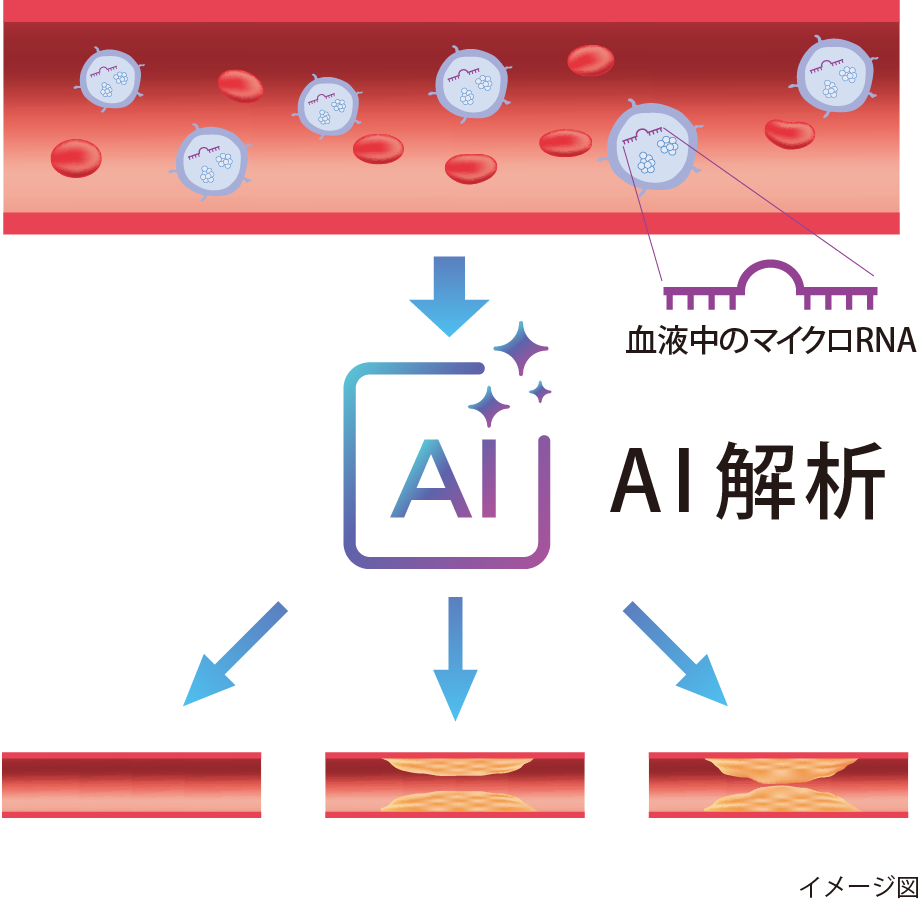 図5 三大動脈硬化症に対して細胞外小胞内マイクロRNAの発現パターンと病態との関係性をAI（機械学習）で結びつける診断モデル