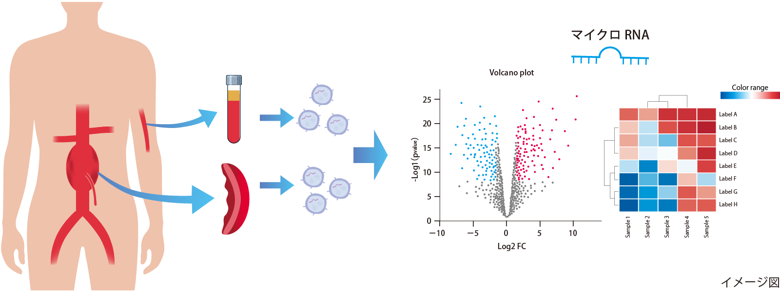 図6 細胞外小胞やマイクロRNAを用いて腹部大動脈瘤の病態を解明する研究の取り組み